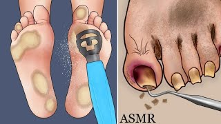 Foot cleaning ASmr Animation|skincare Animation|#skincare #gameplay @smilebam_asmr