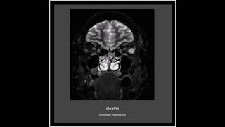 Cloama - Final Monument