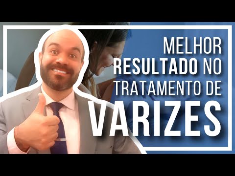 🔴 Como ter Melhores Resultados no seu Tratamento de Varizes [Cuidados na Escleroterapia e Espuma]