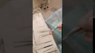 Почему иногда требуется брать кусочек хряща из ребра при ринопластике и сильно ли это страшно?