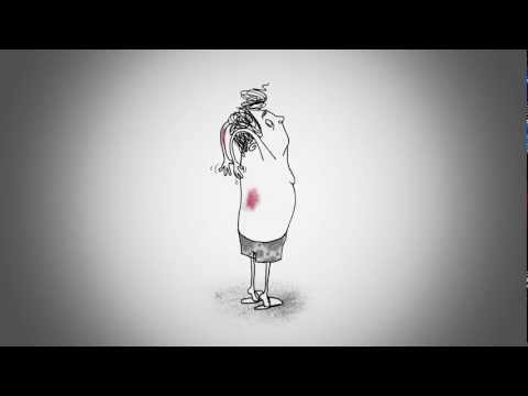 Psoriasis utvecklas under huden