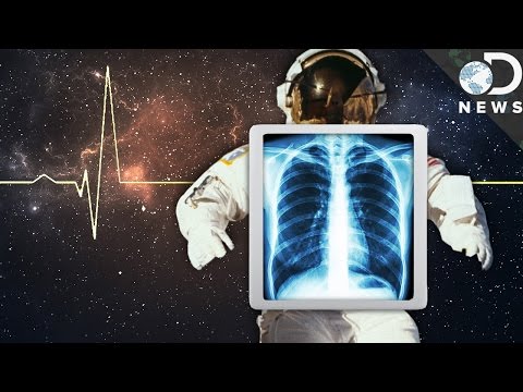 Space Is Trying To Kill Us! How Astronauts Survive