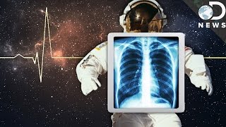 Space Is Trying To Kill Us! How Astronauts Survive
