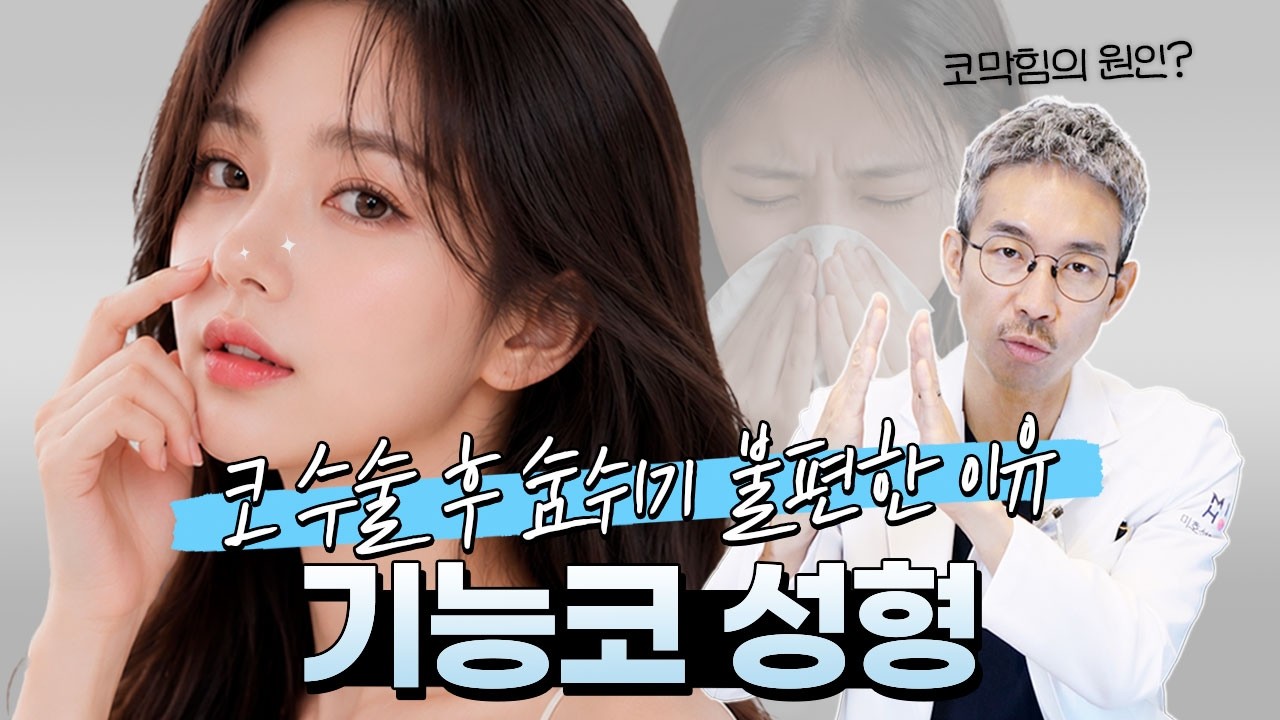 Functional rhinoplasty video