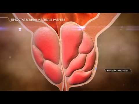 Prostate Saft Verkehr Zuordnung Neue Medikamente für Prostatakrebs