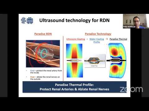An Overview of Renal Denervation, Dr. Felix Mahfoud