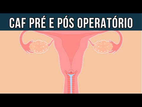 Cuidados antes e depois da Cirurgia de Alta Frequência (CAF) / LEEP / EZT -  Pré e pós operatório