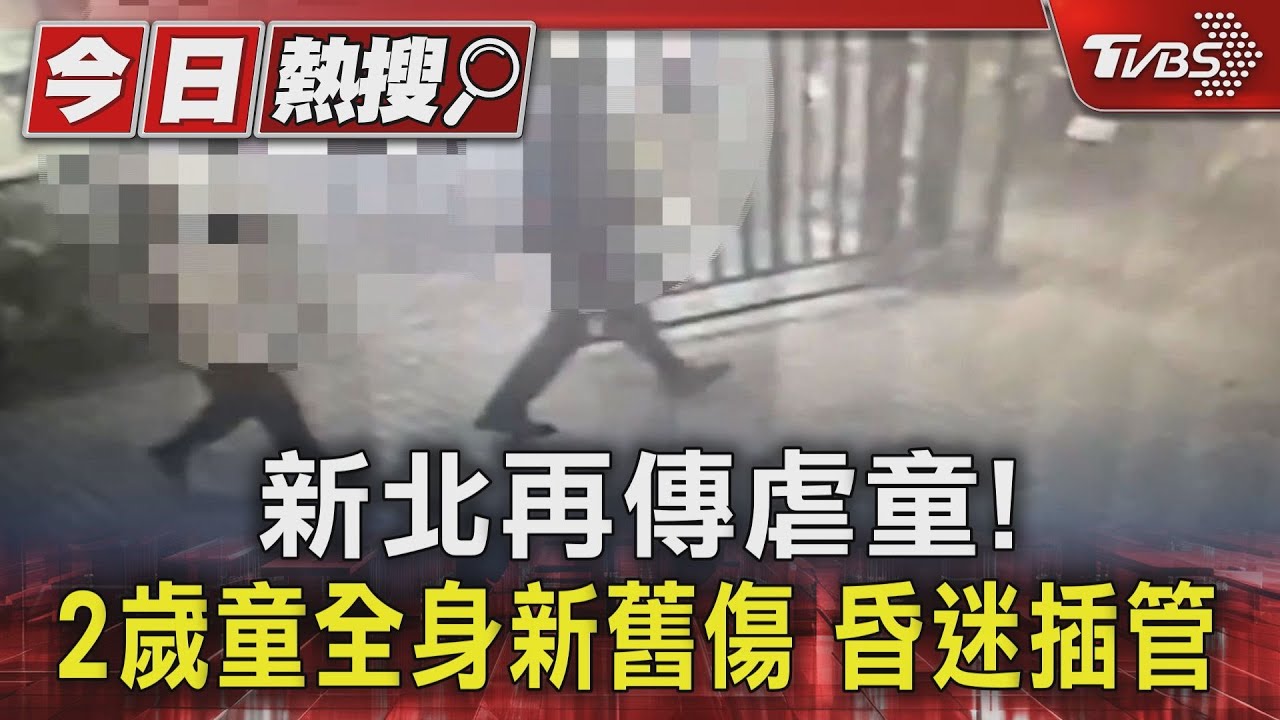 新北再傳虐童！　2歲童全身新舊傷昏迷插管