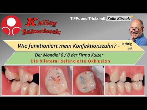Kalles Zahncheck - Die bilaterale dynamische Okklusion