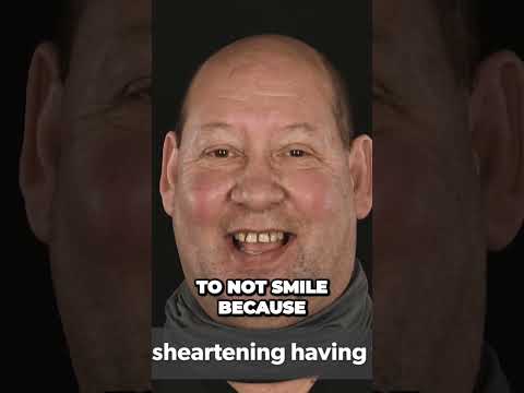 #shorts  Transforming My Smile How Teeth in a Day Changed My Life