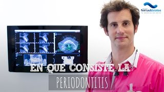 Periodontitis: En qué consiste y cómo prevenirla en la clínica Ferrus&Bratos de Madrid - Jorge Ferrús Cruz