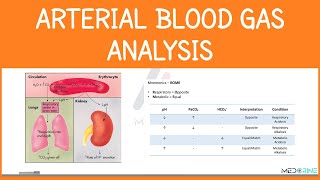 Arterial Blood Gas Analysis Interpretation Simplified