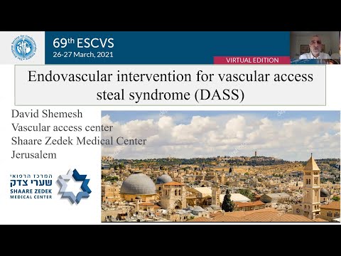 Endovascular intervention for vascular access steal syndrome