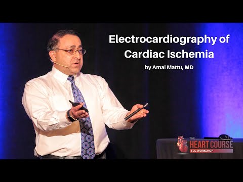 image-What heart problems can an ECG detect?