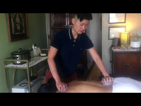 Myofacial Cupping Demo with Julie Wang - YouTube