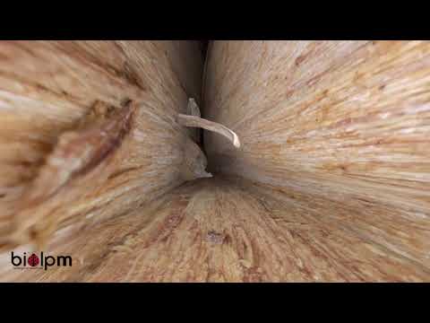 Travel Deep Inside a Leaf   Annotated Version   California Academy of Sciences 1