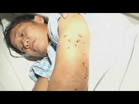 Китай: шершни-убийцы закусали до смерти более 40 человек (новости)