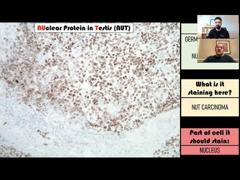 Immunohistochemistry in Pathology