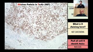 Download the video "Immunohistochemistry in Pathology"