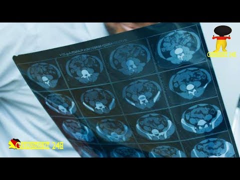 Hypophyse – Hormondrüse im Türkensattel