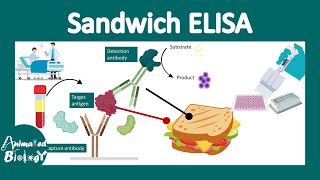 Sandwich ElISA | Principle and application of Sandwich ELISA | Techniques in biology