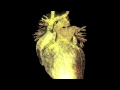 Bullion - Long Promised 
