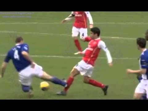 Eduardo Da Silva | Lom noge