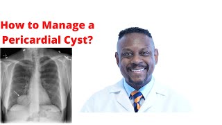 How To Manage a Pericardial Cyst