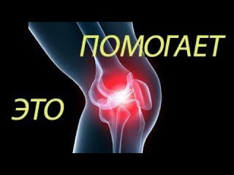 Dolore dopo la manipolazione X-ray normale articolazione del ginocchio