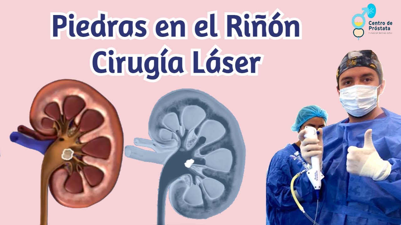 Bruno Rubí López-12