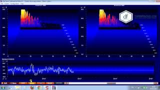PIRACETAM + ALPHA GPC (Day 1)