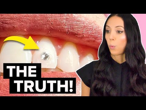 Tooth Gems: Are They Safe? Dental Expert Reacts