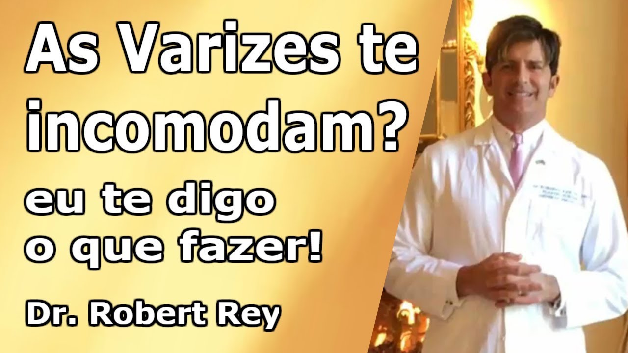 Dr. Rey - as varizes incomodam você? eu conto porque e digo o que fazer!