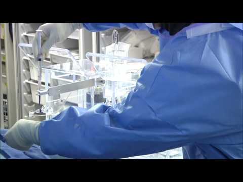 Transradial Radioembolization of HCC using Segmentectomy Technique