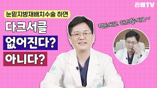 눈밑지방재배치수술하면 다크서클도 사라질까요? 눈밑지방수술의 모든 것, 팩트체크 해드립니다.