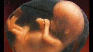 How To Perform A Coathanger Abortion: Bill Nye Lost Episode