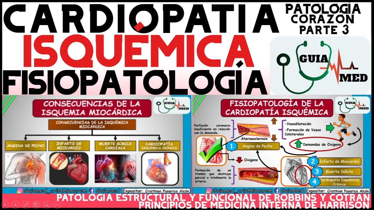 CARDIOPATÍA ISQUÉMICA FISIOPATOLOGÍA | GuiaMed