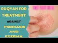 Ruqyah For Treatment Angaist Psoriasis And Eczema TAKE YOUR SHIFA SubhanAllah