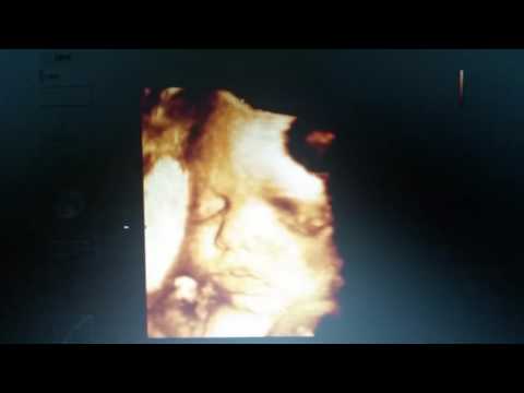 30 semanas de embarazo ecografía 4D ecox