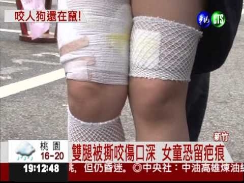 6野狗撲咬! 4歲女童身心受創