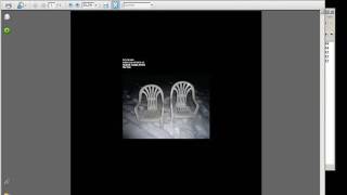 Ruede Hagelstein - Emergency