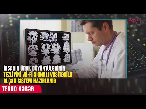 TEXNO XƏBƏR 15.09.2025