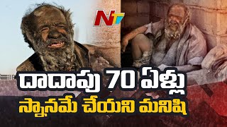 World’s Dirtiest Man: 87 Year Old Man Doesn’t take bath Since 67 Years