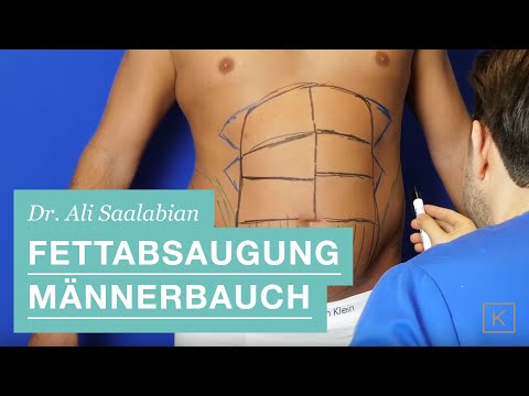 Der Meniskus des Knies Verstauchung Moskau Krankenhäuser für die Behandlung der Wirbelsäule