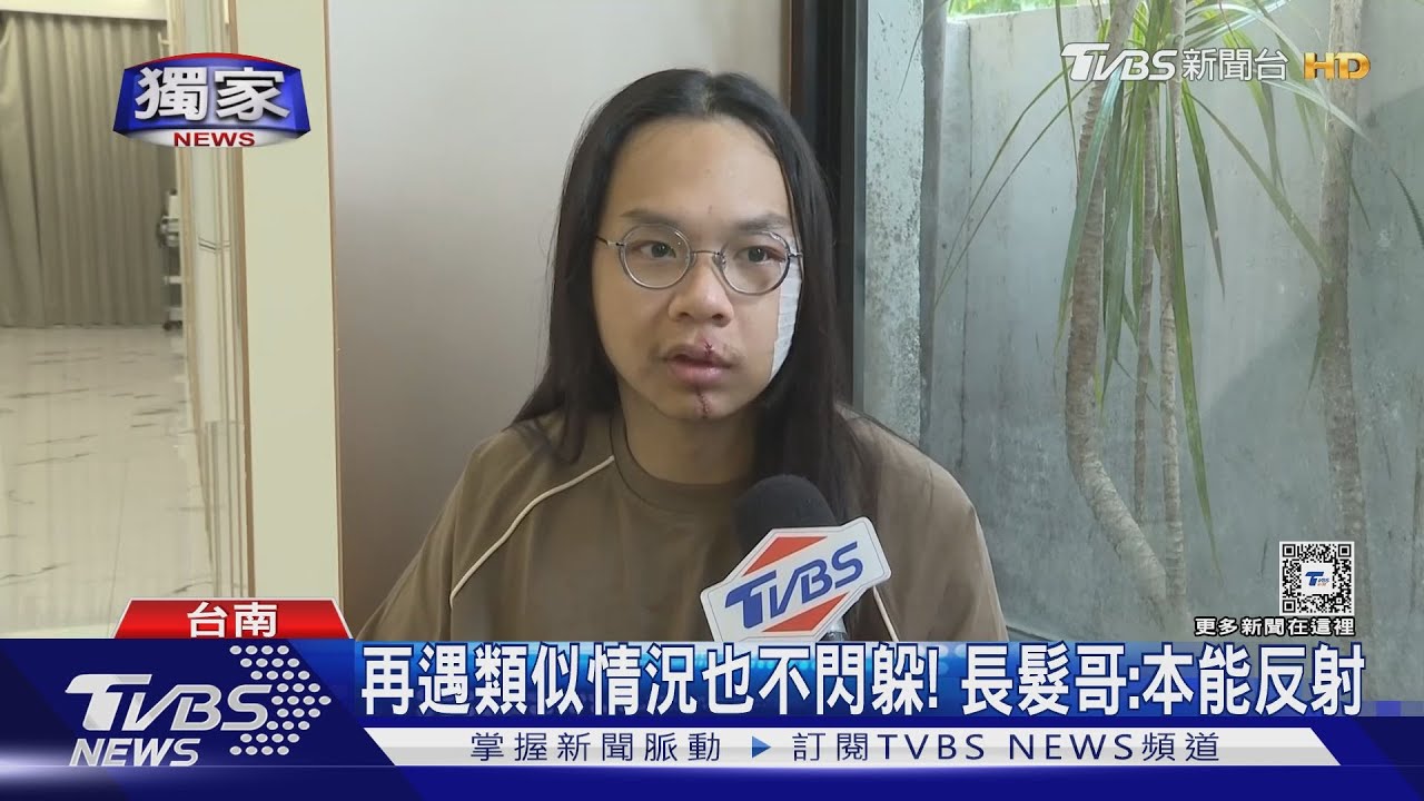 讓家人安心!中捷「長髮哥」除疤 躺高壓氧艙治療