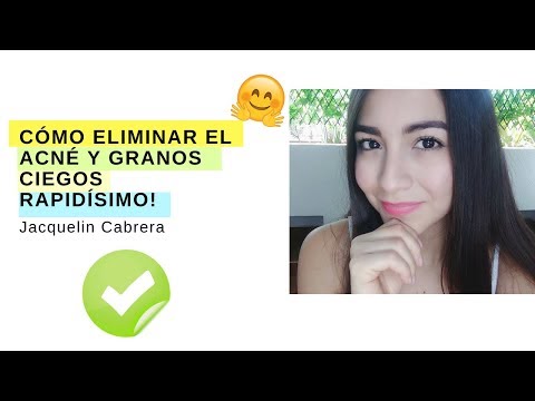 download lagu mp3 mp4 Como Sacar Barros Ciegos, download lagu Como Sacar Barros Ciegos gratis, unduh video klip Como Sacar Barros Ciegos