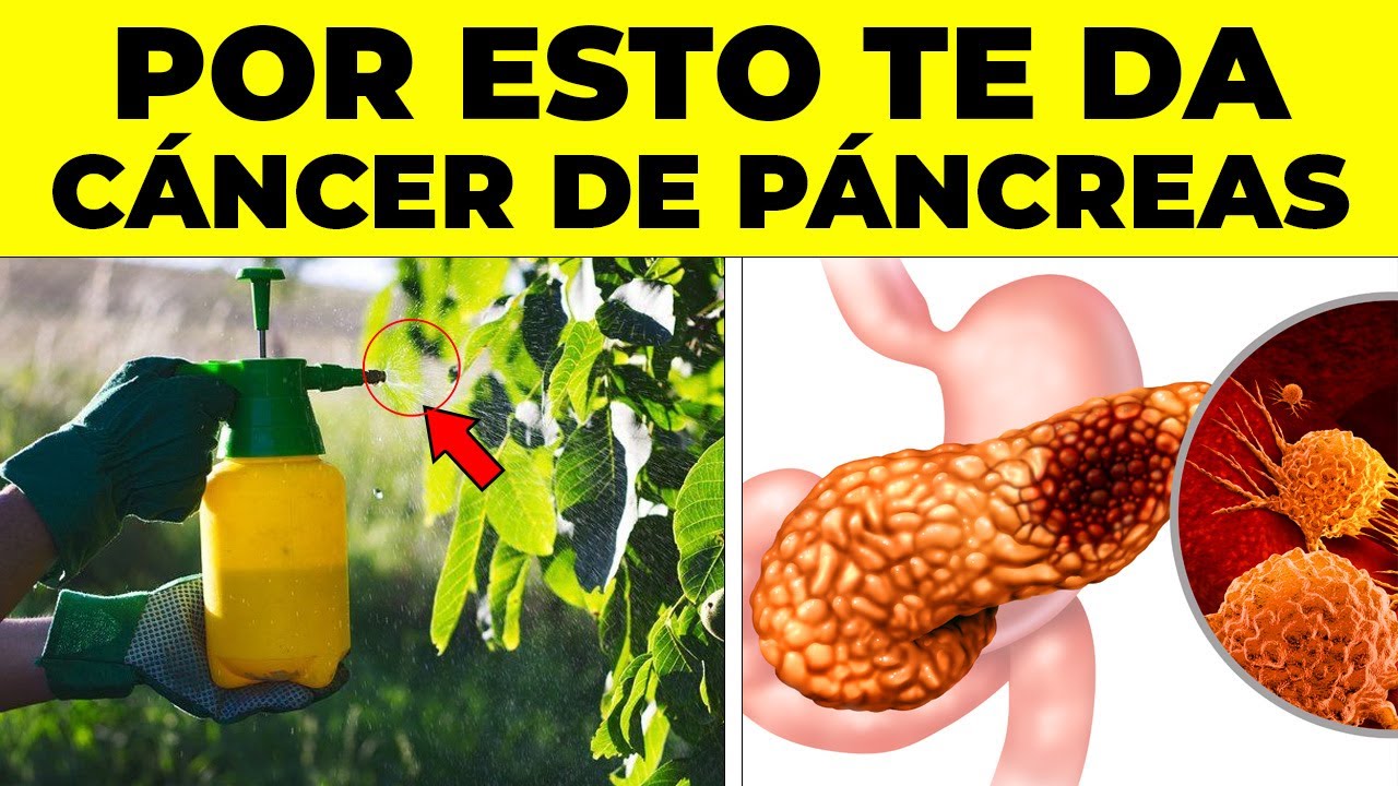 ¡ALERTA! Este error común en tu casa CAUSA CÁNCER de PÁNCREAS, no lo hagas