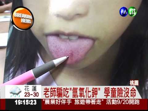 老師騙吃強鹼! 學童舌頭潰爛