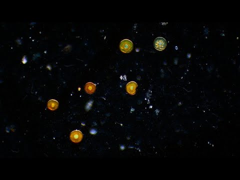 Arcella Amoebae - Relaxing/Studying - Microscopy