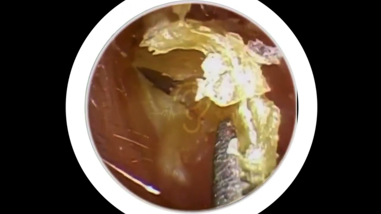 #掏耳朵 #采耳 #强迫症 快手